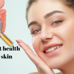 Gut Health for Clear Skin