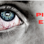 What is Commonly Misdiagnosed as Pink Eye