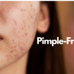 pimple-free skin at home