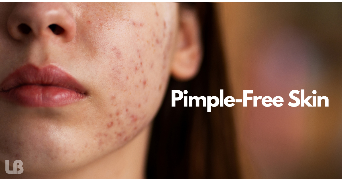 pimple-free skin at home